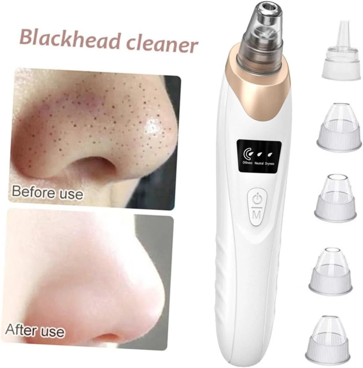 Blackhead Removal Machine – Skin Care & Pore Cleaner - AuraVibezs.store