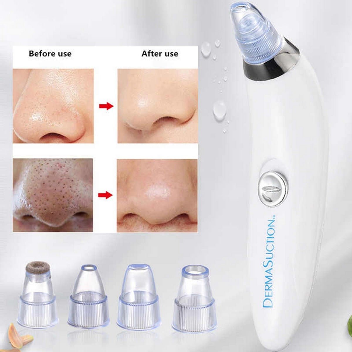 Derma Suction 4 in 1 Black Head Remover Machine - AuraVibezs.store